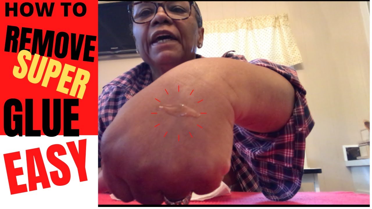 EASY WAY TO REMOVE GORILLA SUPER GLUE OFF SKIN