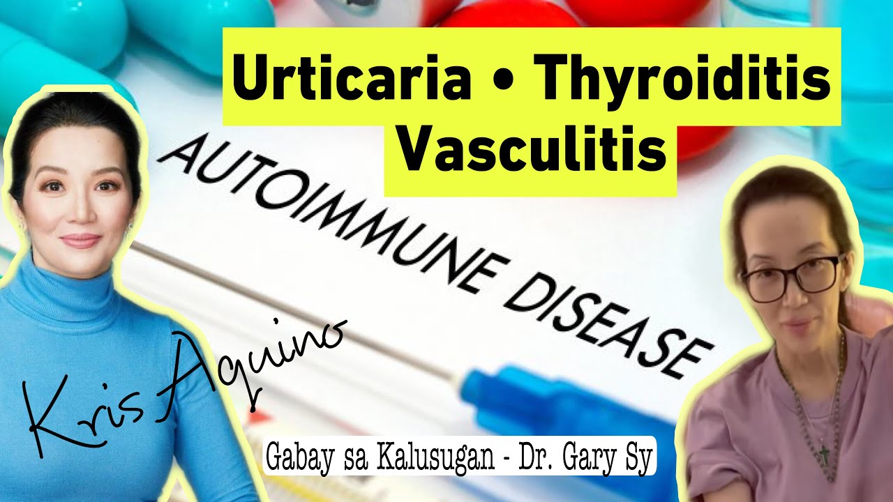 Autoimmune Disorders: Urticaria, Thyroiditis & Vasculitis - Dr. Gary Sy