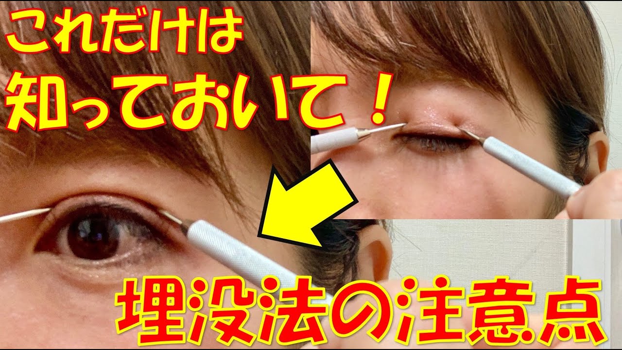 手術を受けて後悔しないために！！イメージが大切！！～クイックコスメティーク・埋没法偏～