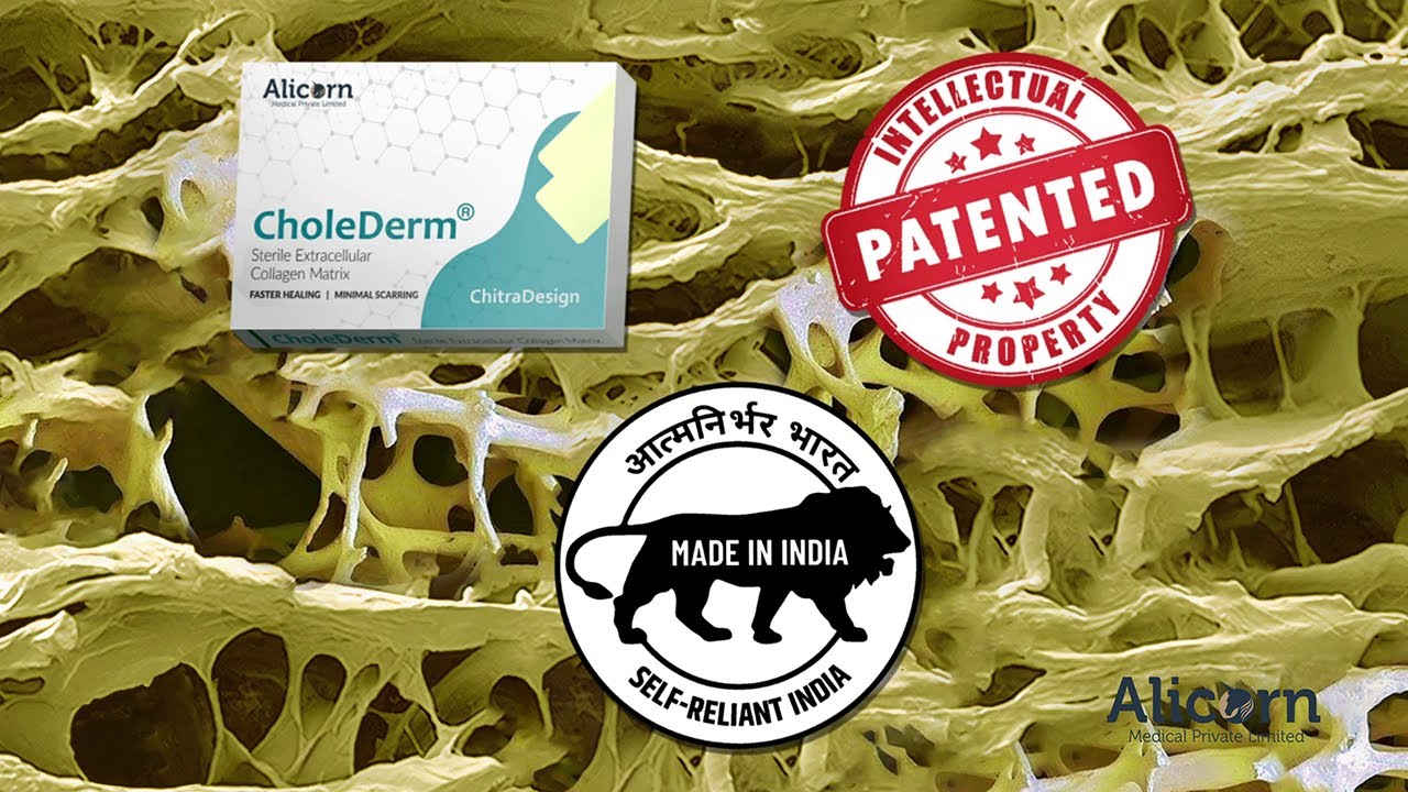 Chronic Wound Healing with CholeDerm&reg; | Advanced Wound Care Product by SCTIMST - 2 Min