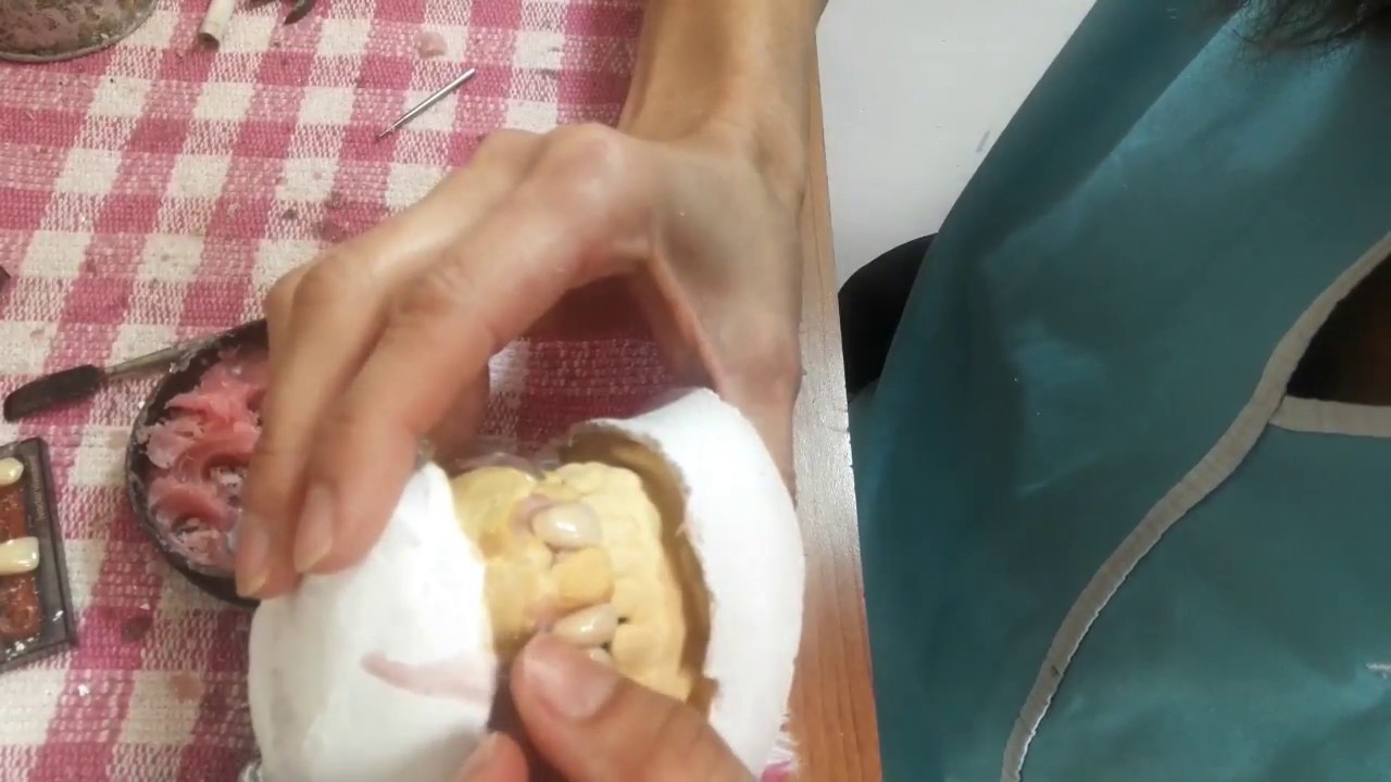 Montaje de dientes y  retenedor transparente