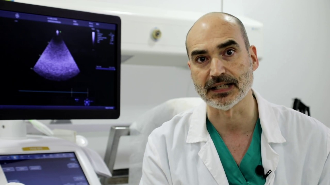 ECOCARDIOGRAMA DE ESFUERZO