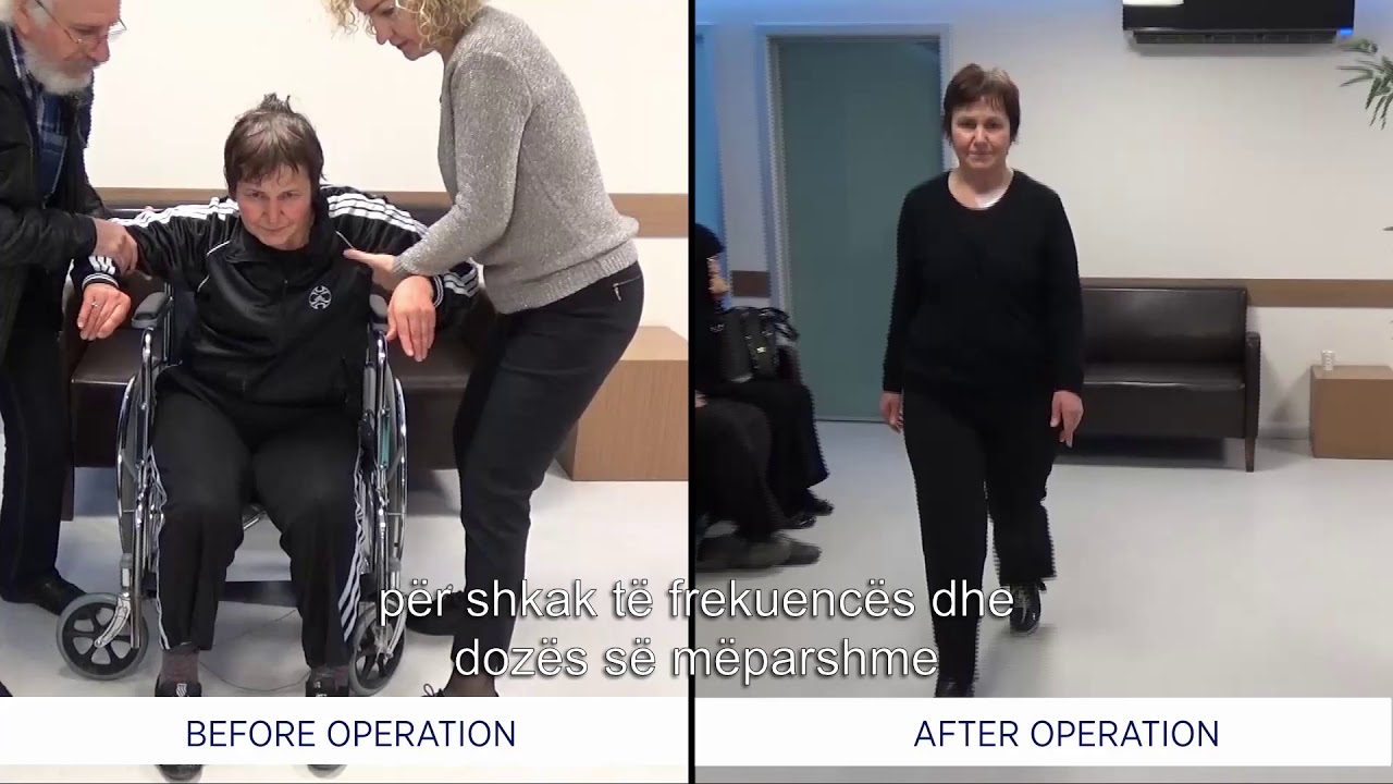 Sëmundja Parkinson dhe metodat e trajtimit për të