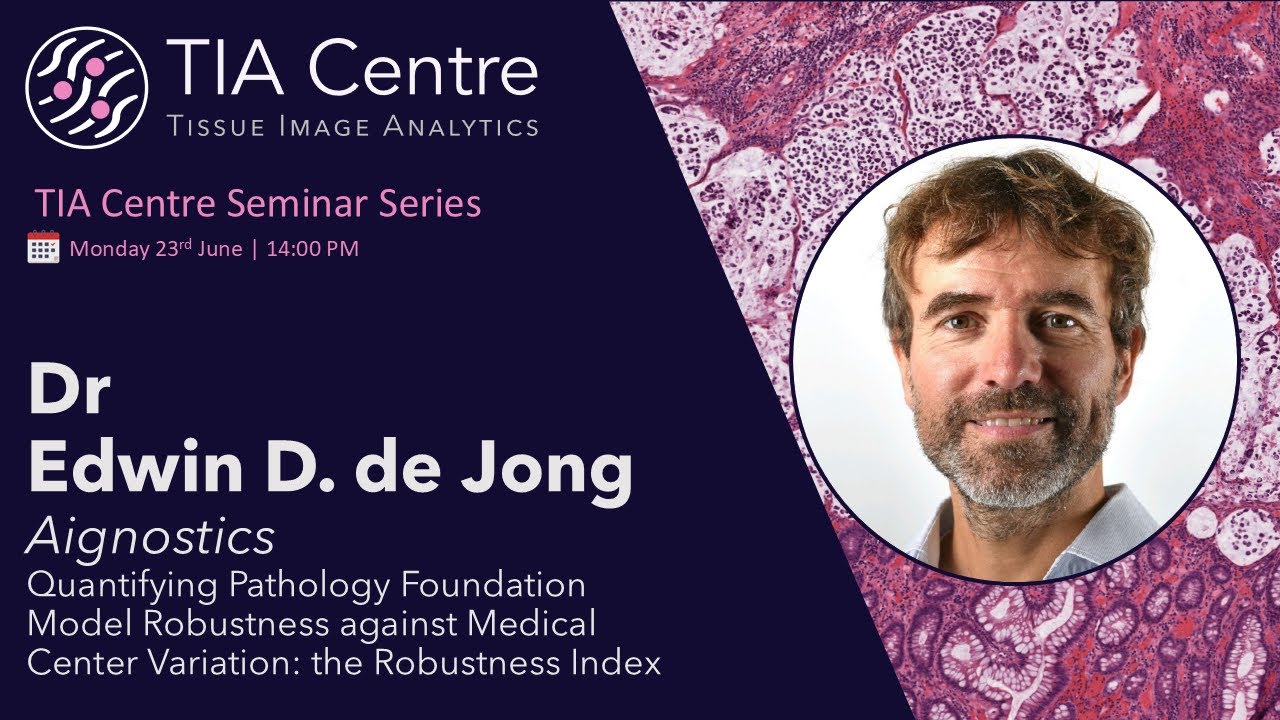 Quantifying Foundation Model Robustness: the Robustness Index: Edwin de Jong, 23/06/25