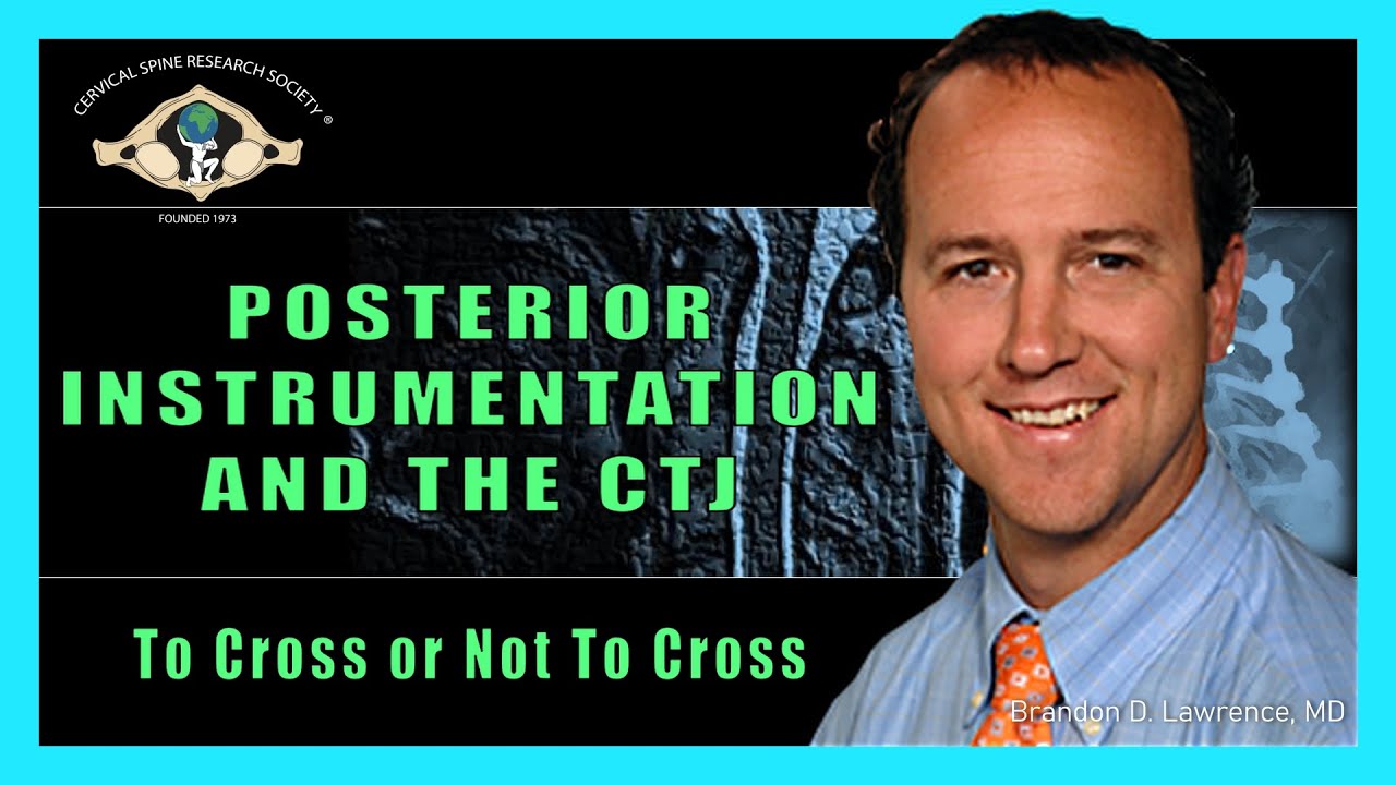 Cervical Myelopathy: Posterior Instrumentation and the CTJ - Dr. Brandon D. Lawrence