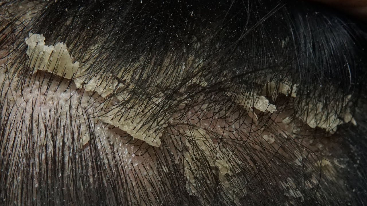 ASMR Ultimate Relaxation 1 Hour Long
