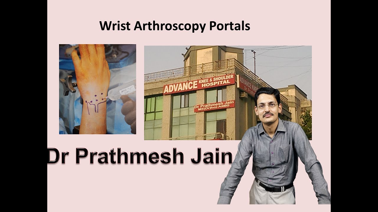 Wrist arthroscopy portals