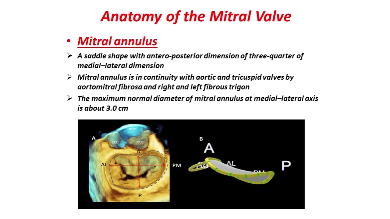 Mitral Stenosis by Dr. Alaa AbdelKader