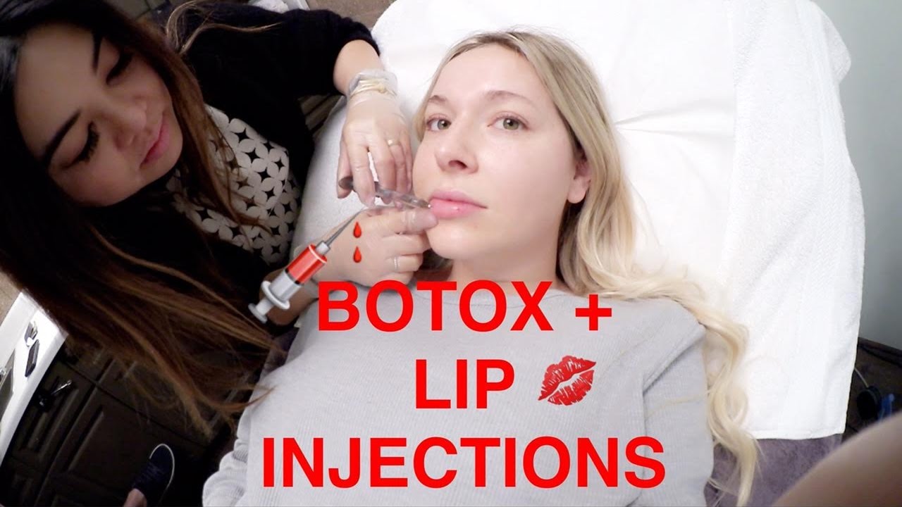 COME WITH ME!!  BOTOX + LIP INJECTIONS