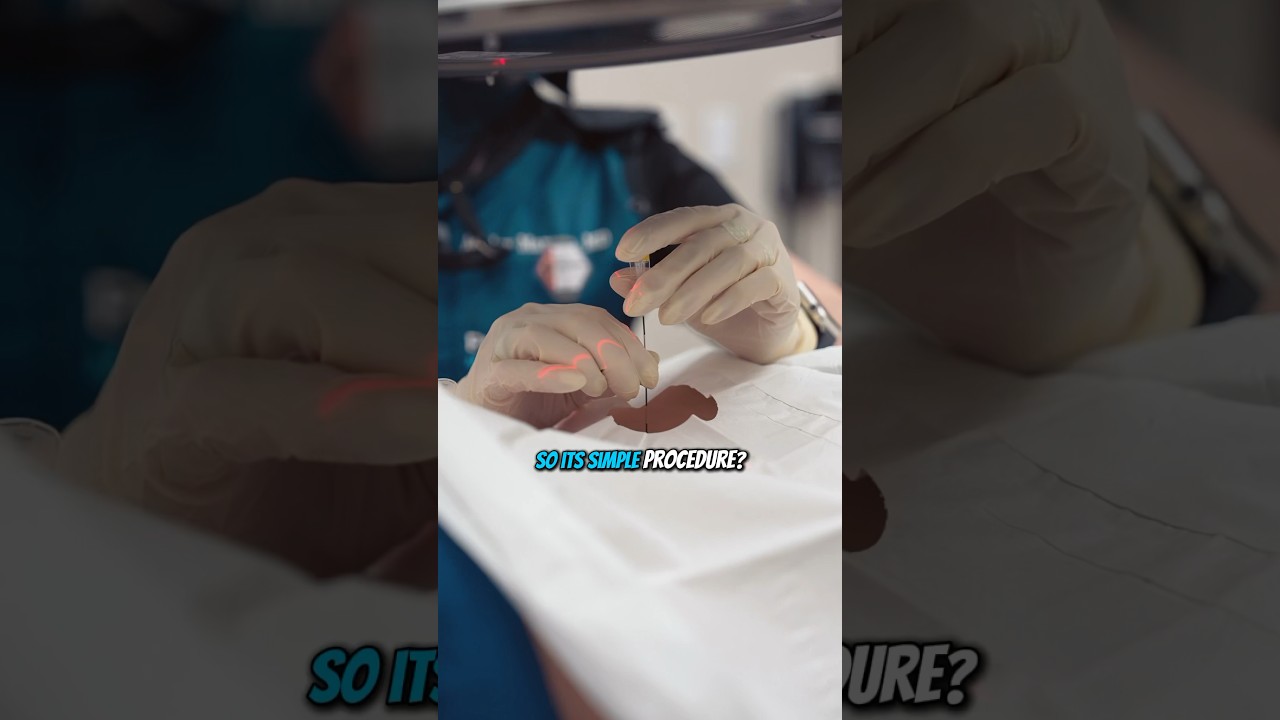 Can epidural injection go wrong? #painmanagement #epidural #doctor
