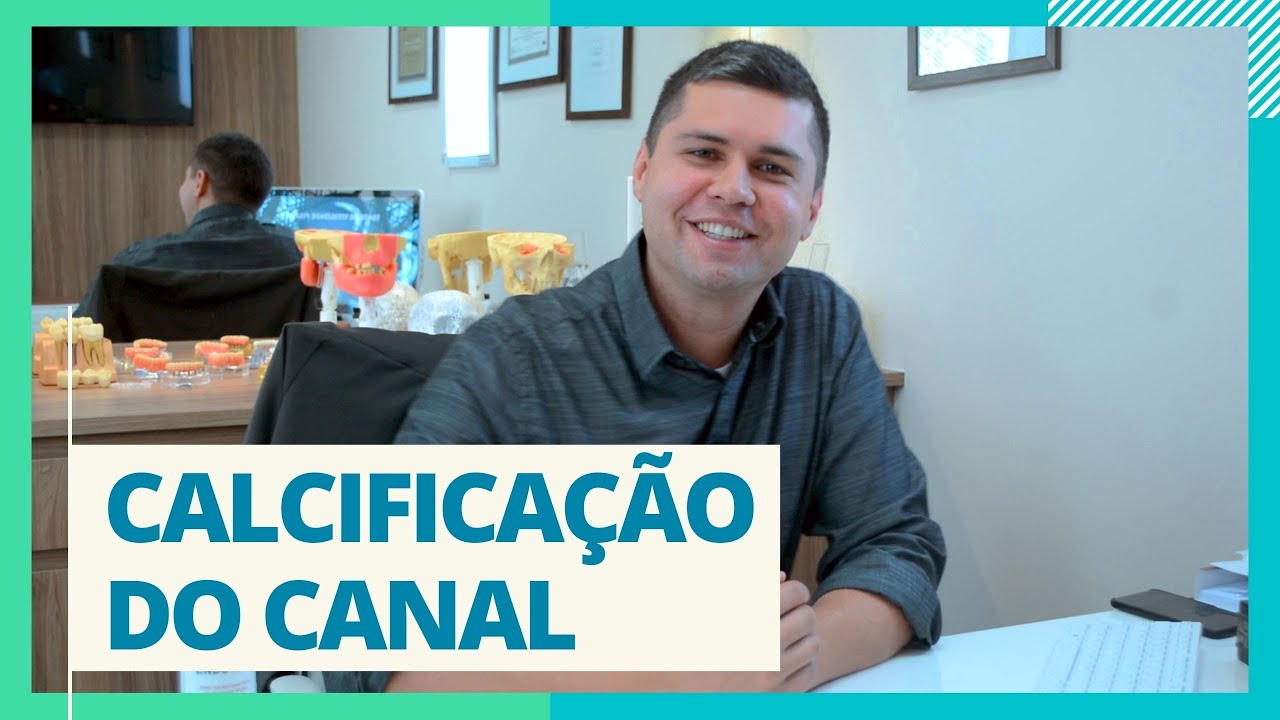 CALCIFICAÇÃO DO CANAL - DR. FERNANDO CARNEIRO