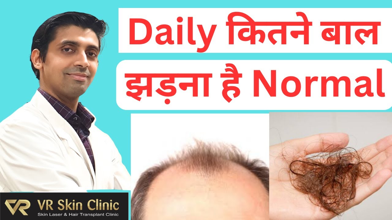Daily कितने बालों का झड़ना Normal  है? How much Hair Fall is Normal?