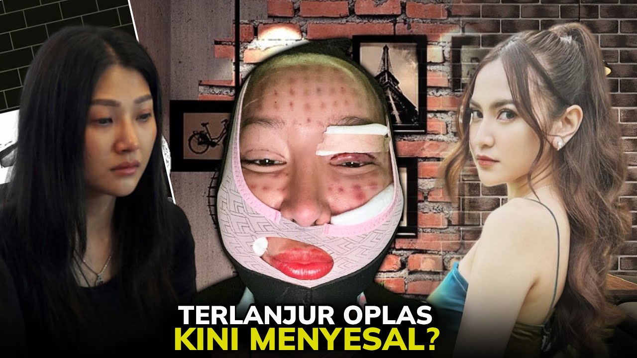 6 Artis yang Lakukan Operasi Plastik di Tahun 2024