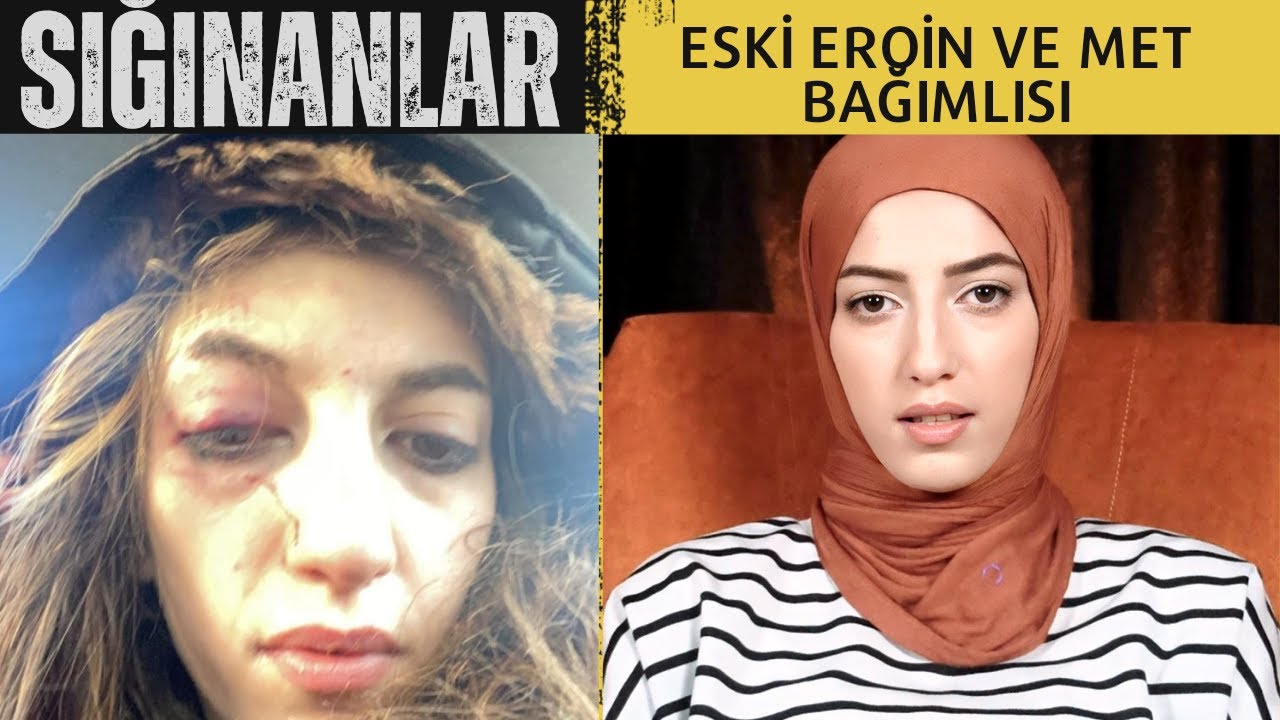 Sığınanlar : Eski Eroin ve MET bağımlısı  'BENİ O AN ALLAH KURTAMIŞ GİBİYDİ' / EROİNLE DANS / B9