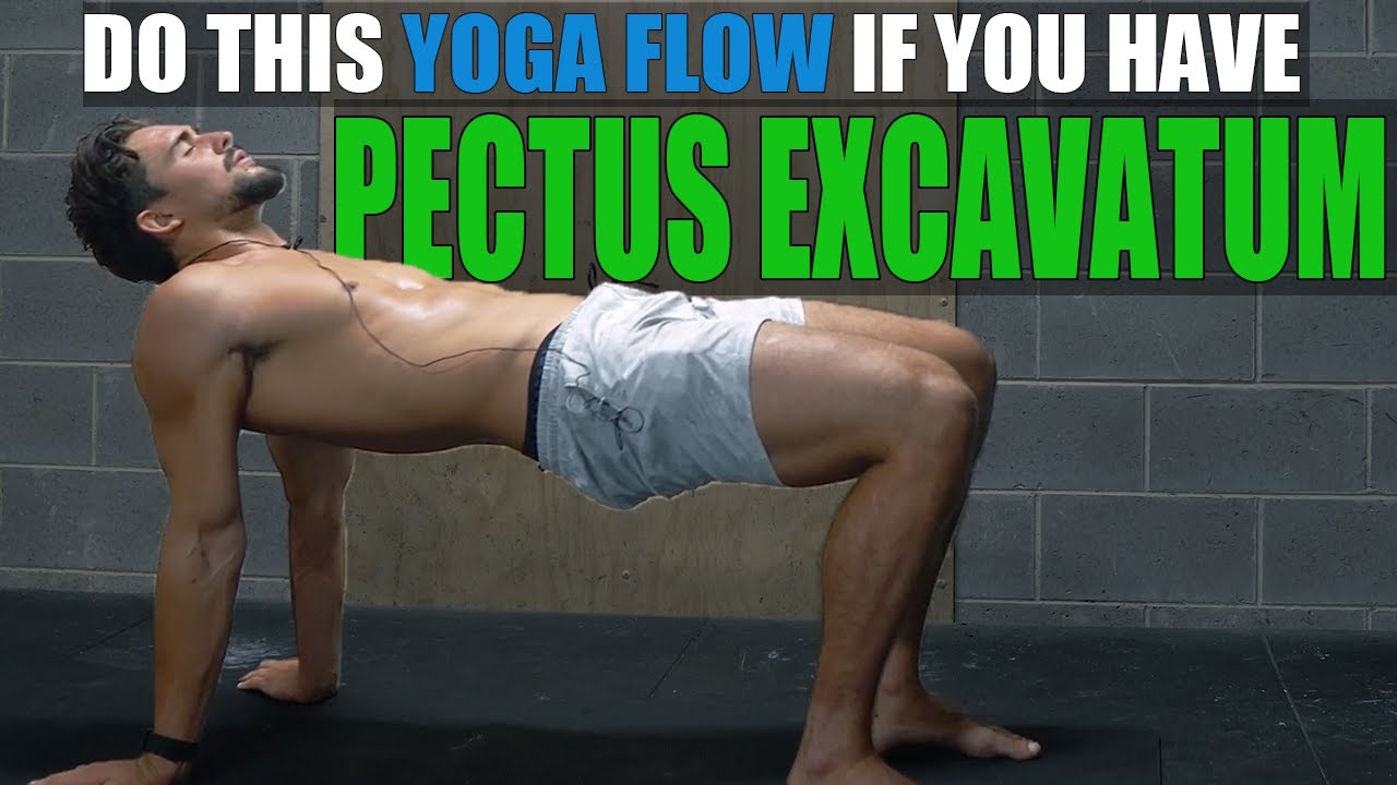 Yoga Flow for Pectus Excavatum Posture!
