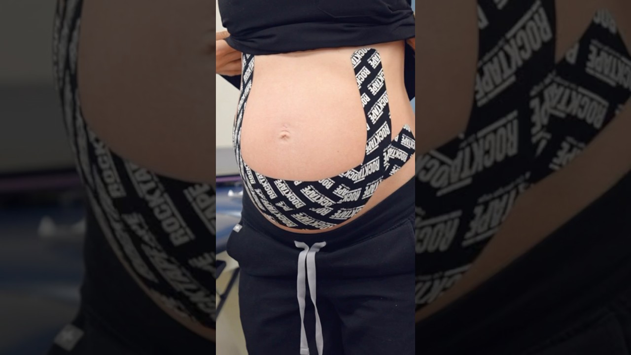 Does KT tape help during pregnancy? #pregnancy #physicaltherapy #taping