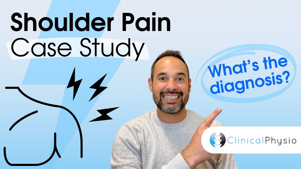 Shoulder Pain Case Study | Expert Physio explains Assessment, Diagnosis and Clinical Reasoning!