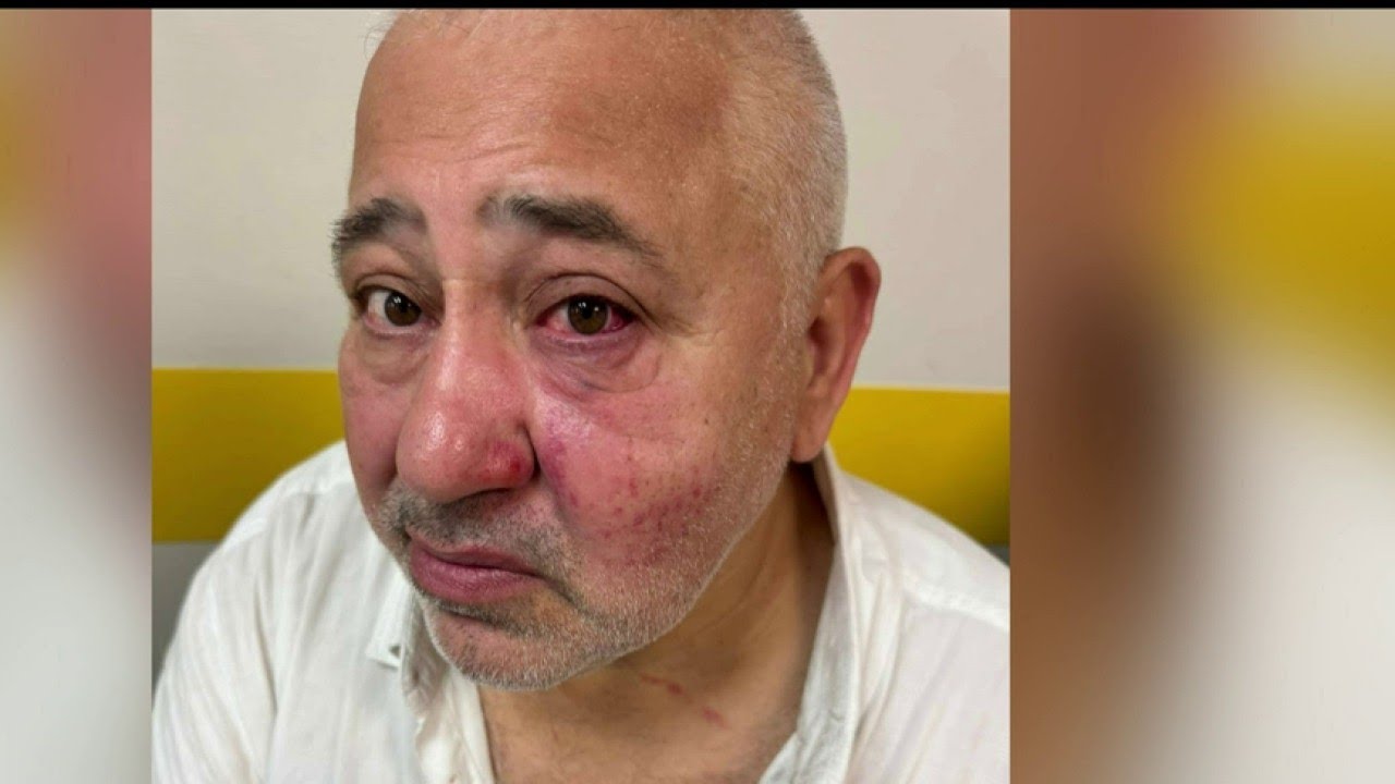 Agression antisémite à Livry-Gargan : la victime raconte sur i24NEWS
