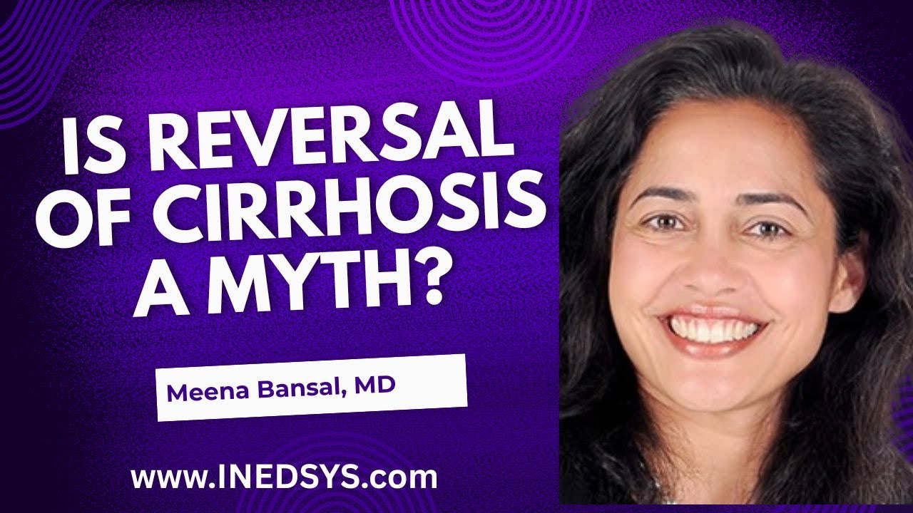 Pathogenesis and Treatment of Hepatic Fibrosis: Is reversal of Cirrhosis a Myth? by Meena Bansal, MD