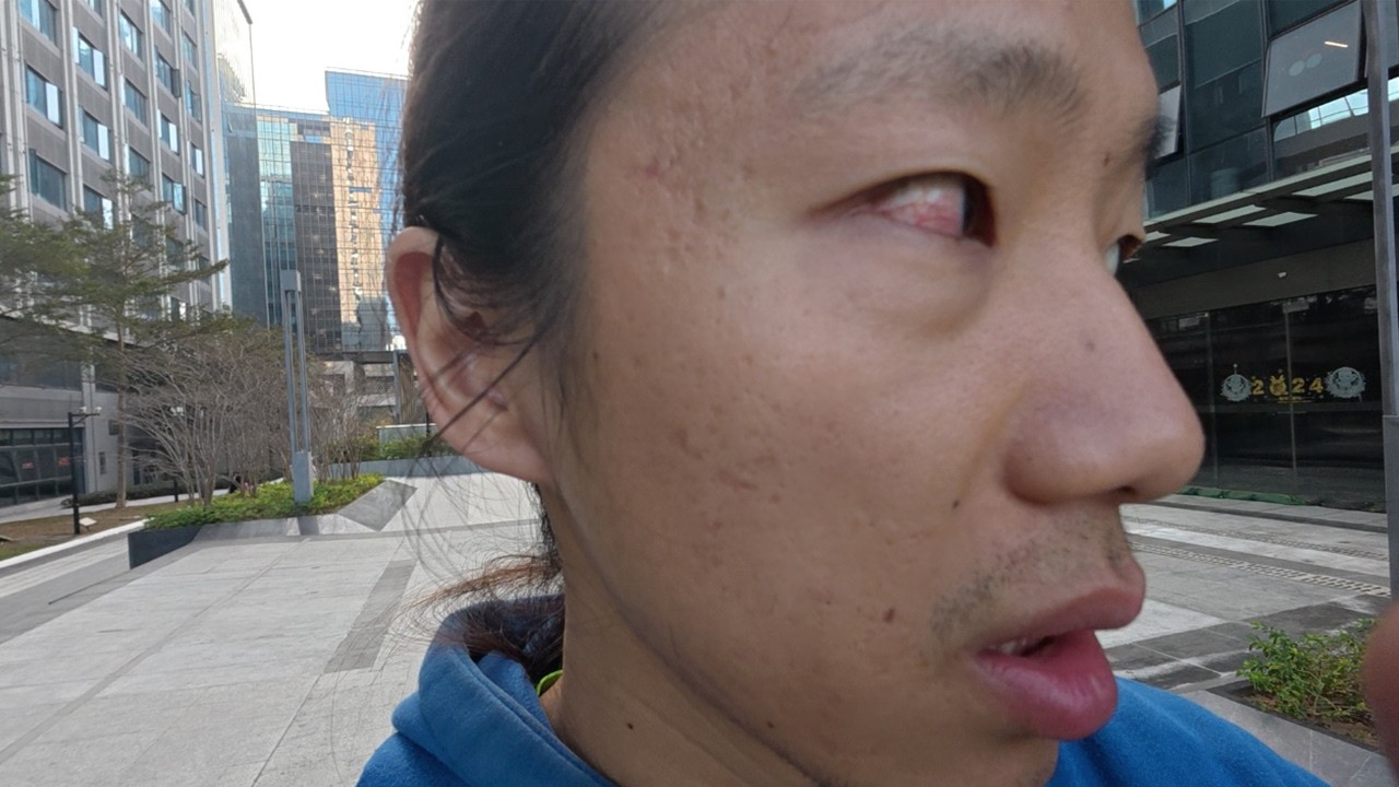 My eyes got red. I need to take care of my eyes better. #dailyxiao 01/29/26