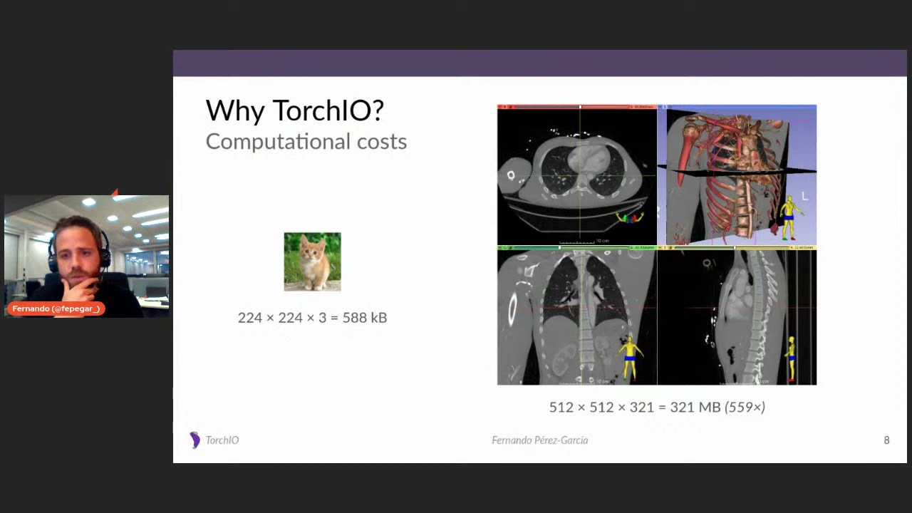 PyTorch Community Voices | TorchIO | Fernando Pérez-García