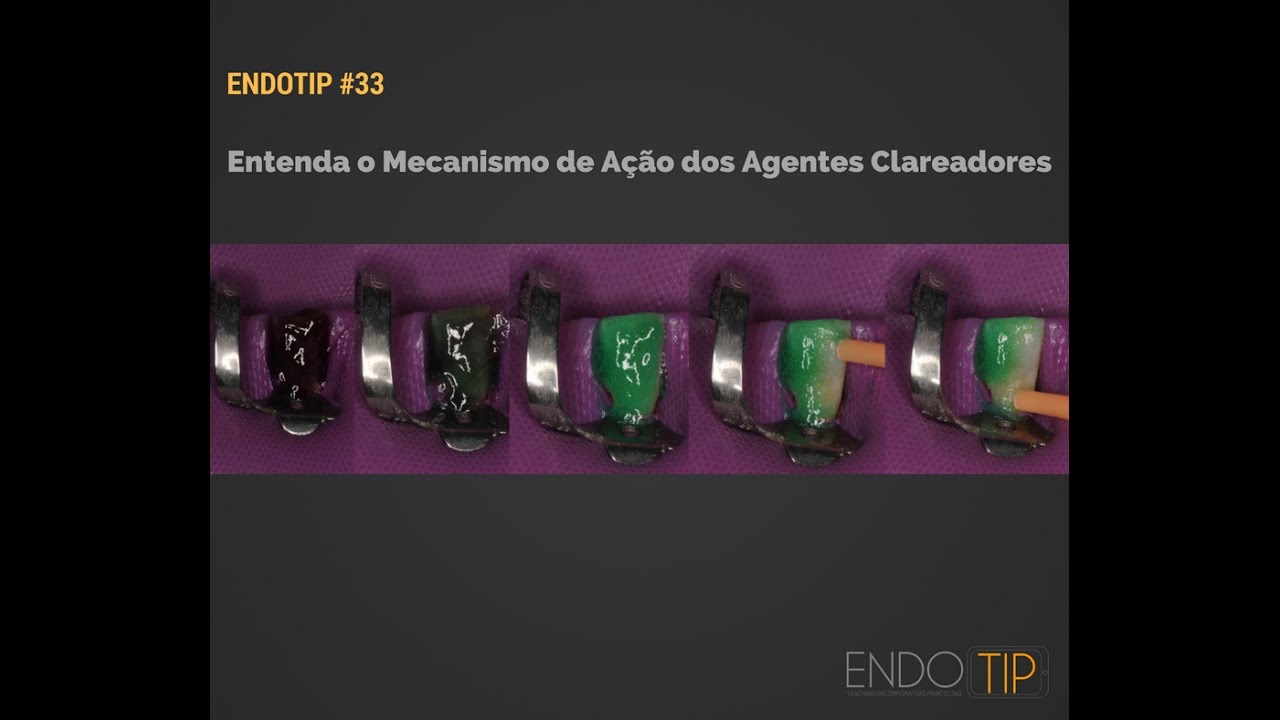 Saiba Como É O Mecanismo De Ação Dos Agentes Clareadores No Clareamento Do Pigmento
