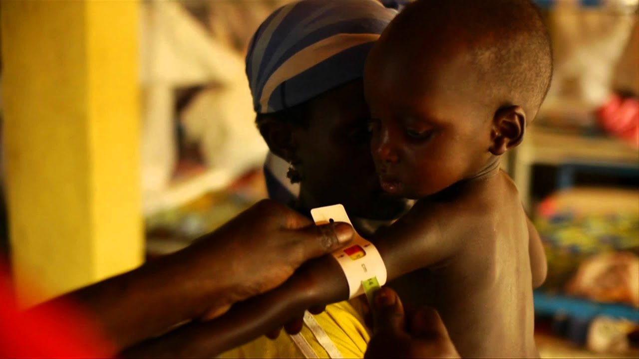 Sharp decline in under-5 mortality in the Niger