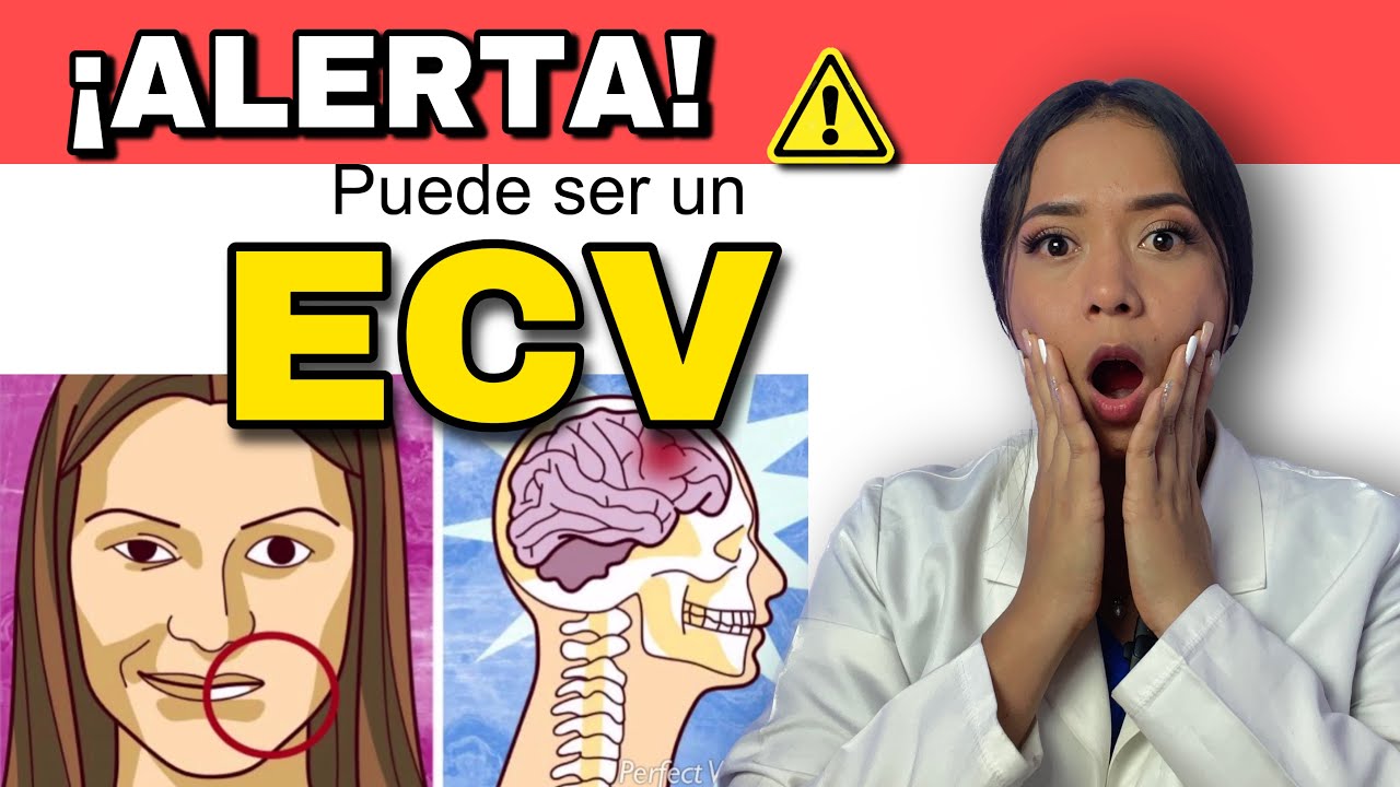 Síntomas de ALERTA de ECV | Enfermedad Cerebrovascular 🧠| ICTUS.