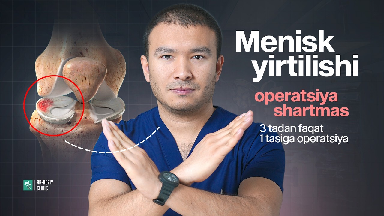 Menisk yirtilishi doim operatsiya EMAS. Doktor haqiqatni aytadi”