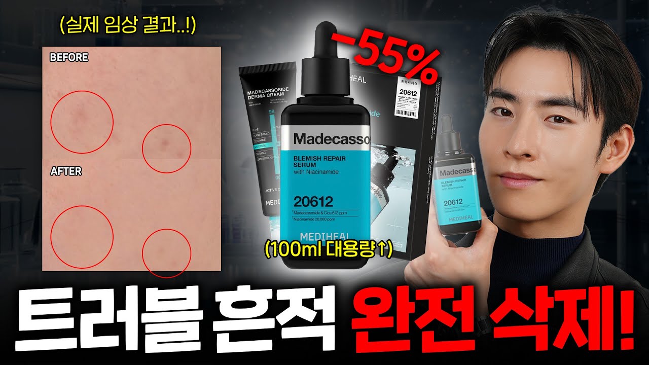 대용량 최저가로 낋여왔슴🔥 흔적 케어 필수 세럼+크림 반값마켓🛒