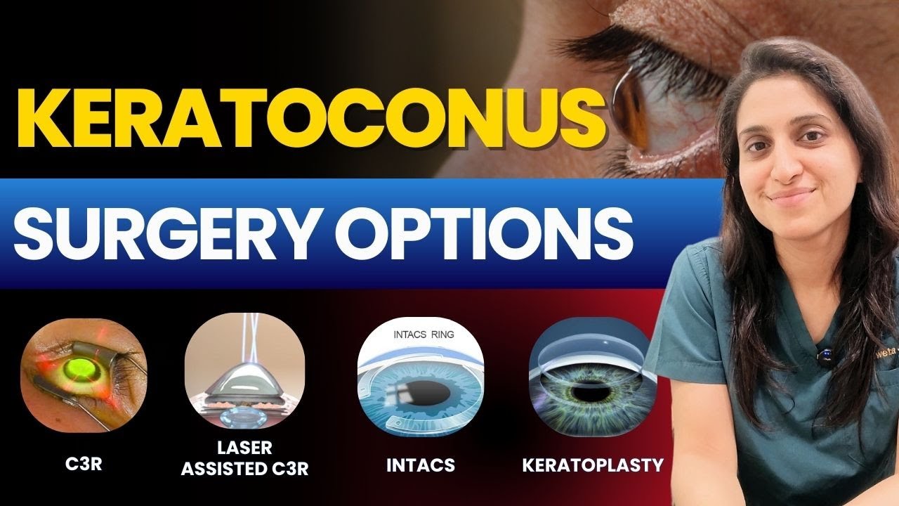 Keratoconus Treatment Options | C3R, TCAT, TREC & INTACS | EyeMantra