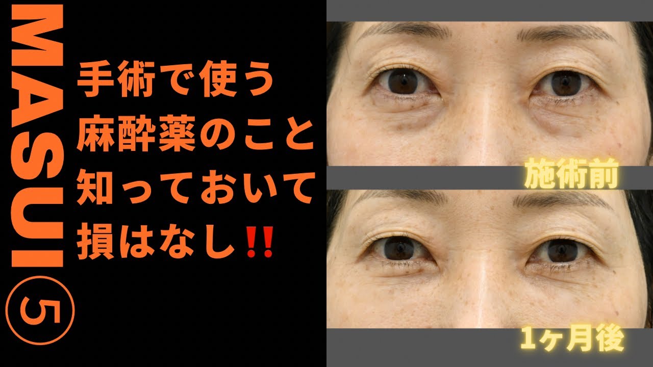手術で使うケタミンってなに⁉️徹底解説‼️