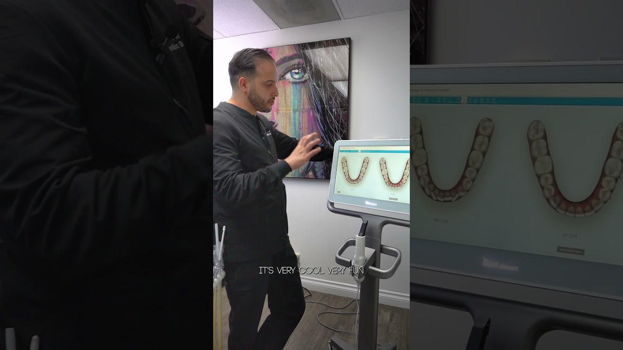 Case review: Invisalign patient..