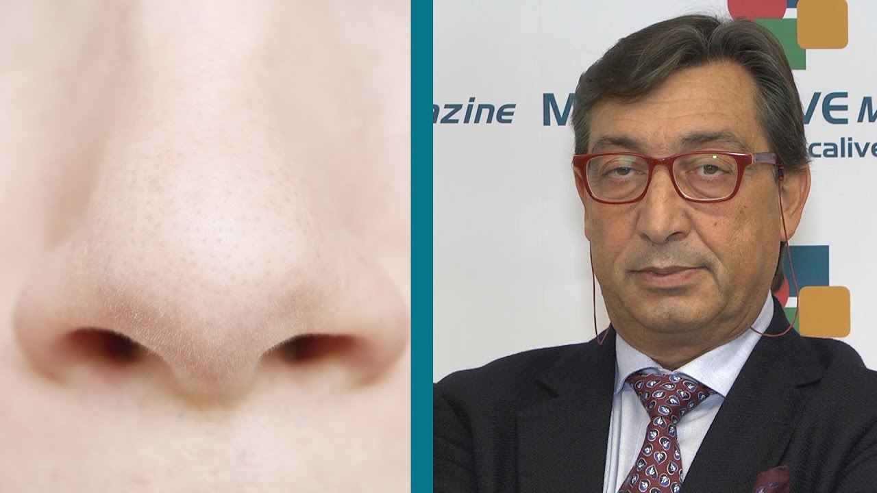 Rinosettoplastica chiusa, intervista al dott. Ignazio Scimè
