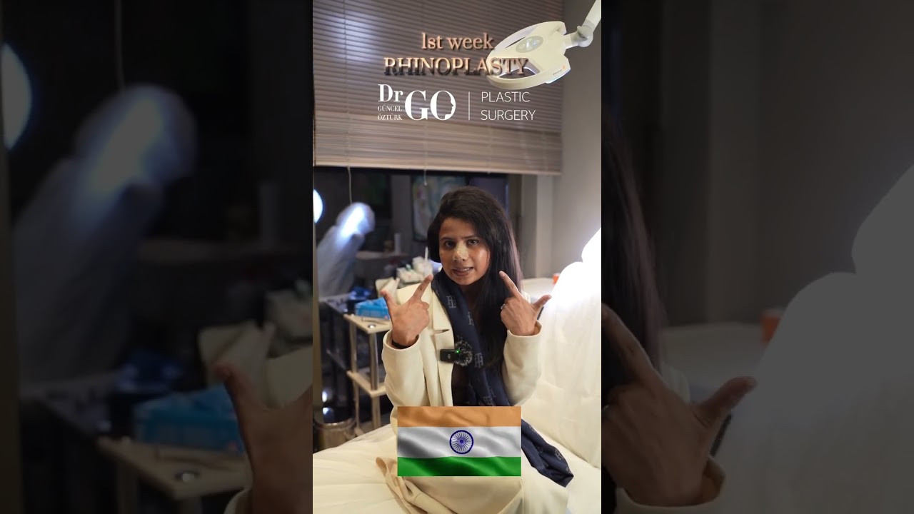 Post-op 1 week Rhinoplasty - Dr Guncel Ozturk