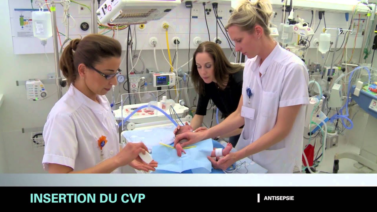 Cathéter veineux périphérique chez le nouveau-né et l'enfant prématuré