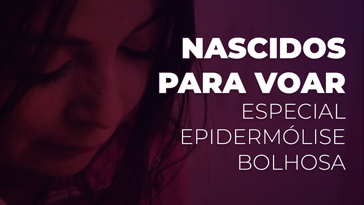 Especial Epidermólise Bolhosa  - Nascidos para Voar