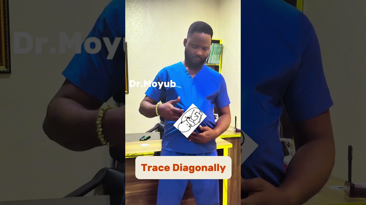 Signs of oblique lie during pregnancy.