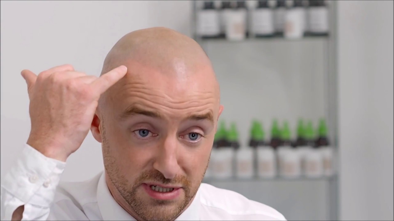 Ciaran's Hair Loss and Finding Micro Scalp Pigmentation with Vinci Hair Clinic