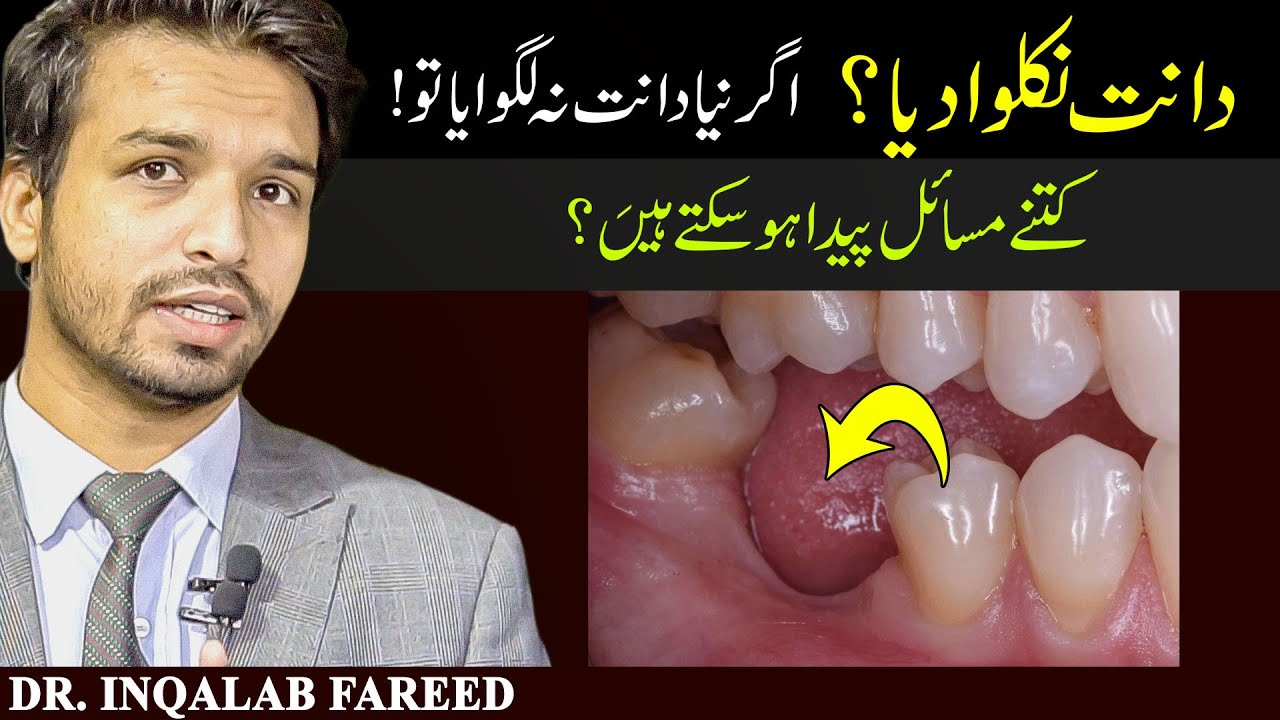 Never Get your TOOTH Removed! | Urdu | Hindi | @InqalabFareed