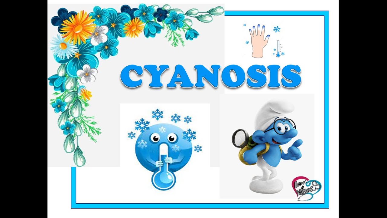 CYANOSIS IN TAMIL| TYPES OF CYANOSIS  || CENTRAL  || PERIPHERAL || DIFFERENCE BETWEEN CYANOSIS TYPES