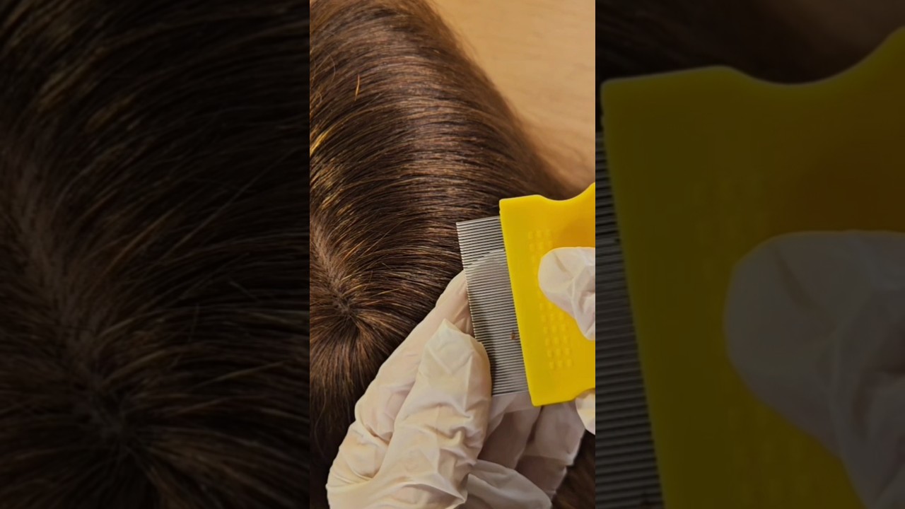 ASMR Lice found while brushing hair with metal comb
