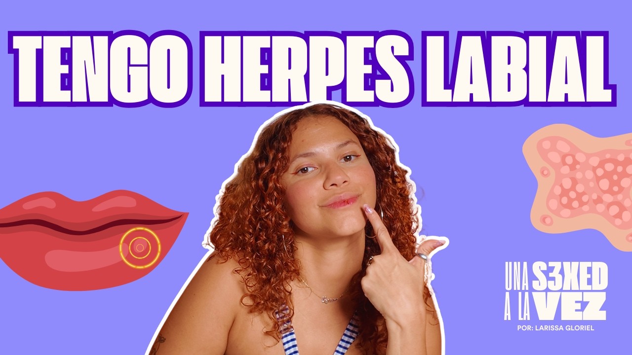 Herpes labial (HSV-1): qué es, cómo se transmite y qué hacer