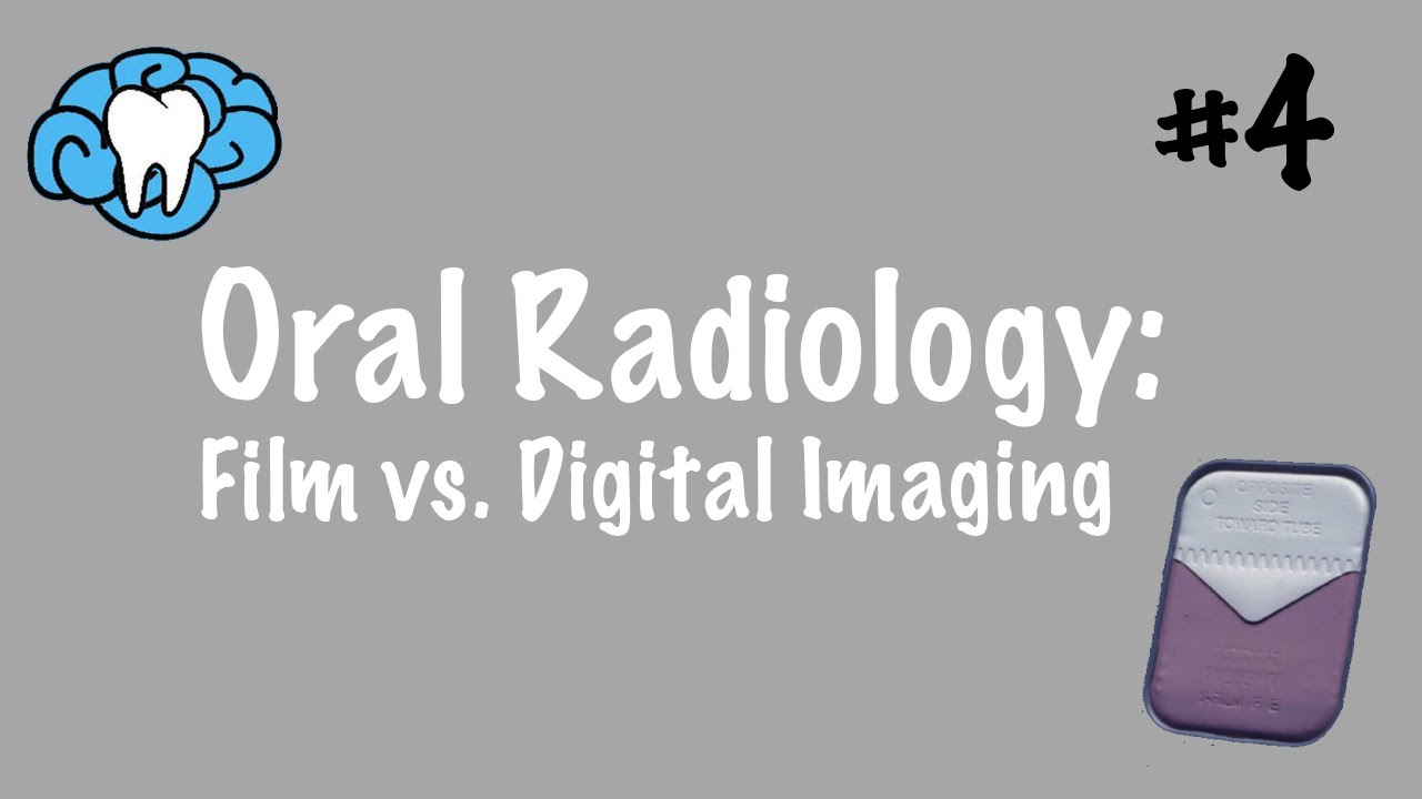 Oral Radiology | Film vs. Digital Imaging | INBDE, ADAT