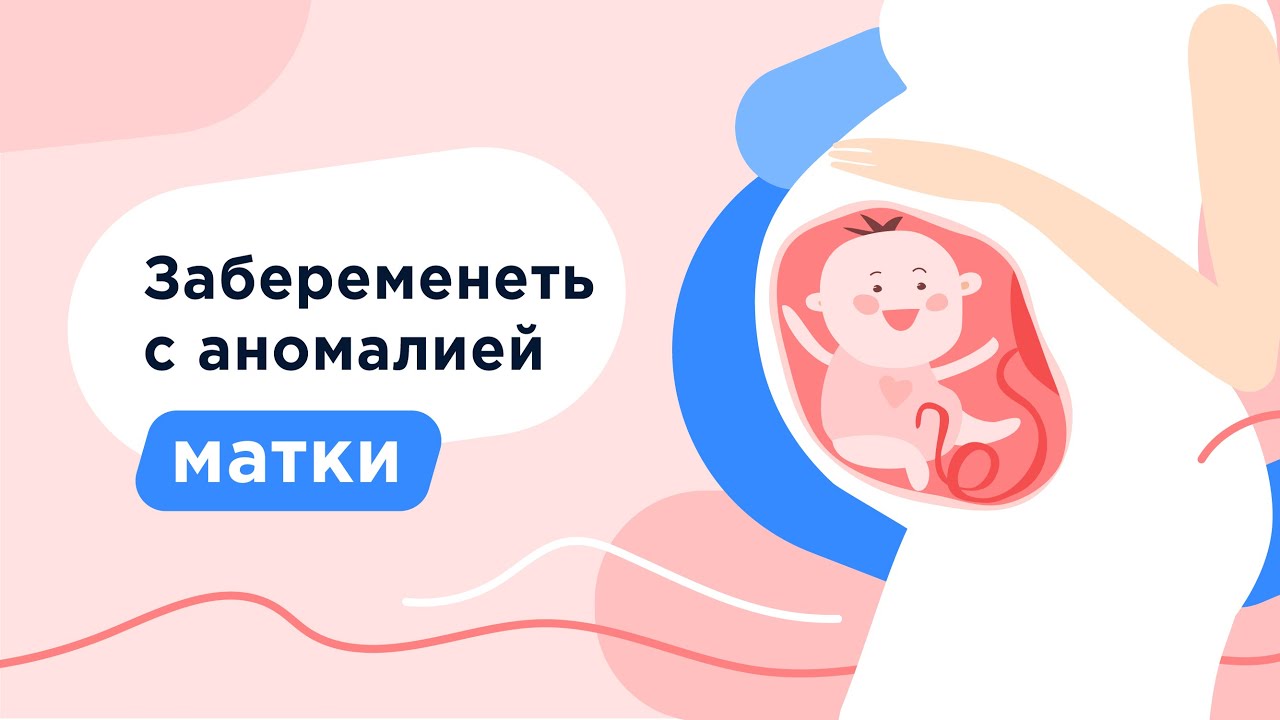 Двурогая матка | Седловидная матка | Однорогая матка | Перегородчатая матка | Гипоплазия матки