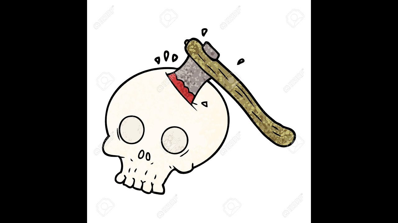 Head injuries