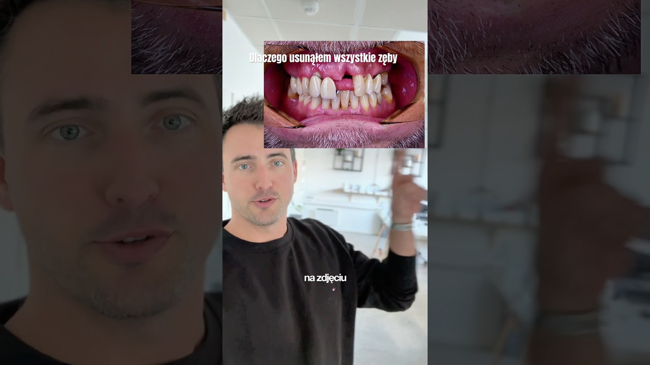 Zapraszam do naszego LABu w Oslo #dentysta #allonx
