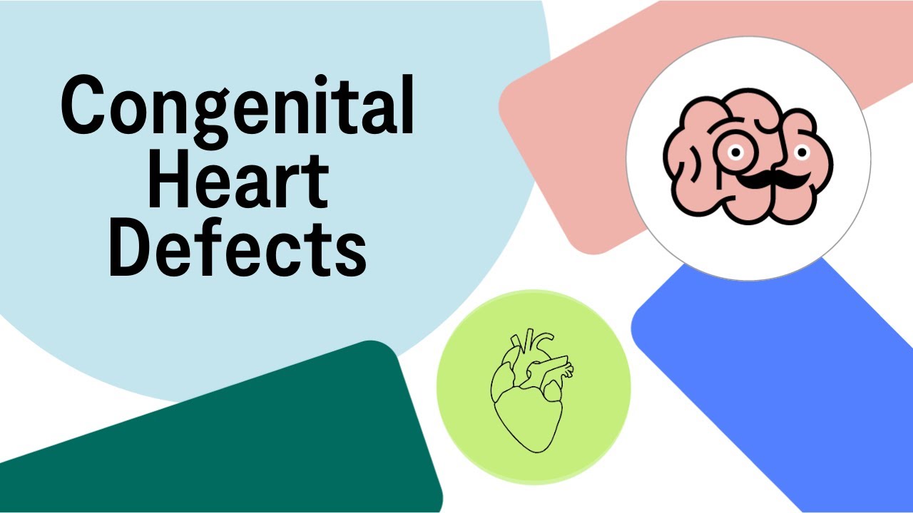 UKMLA AKT Congenital Heart Defects: Management and Complications | Multiple Choice Questions