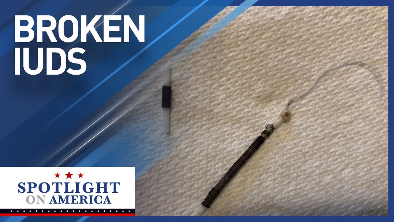 Exclusive: 3,000+ women report a popular IUD broke in their body, causing complications