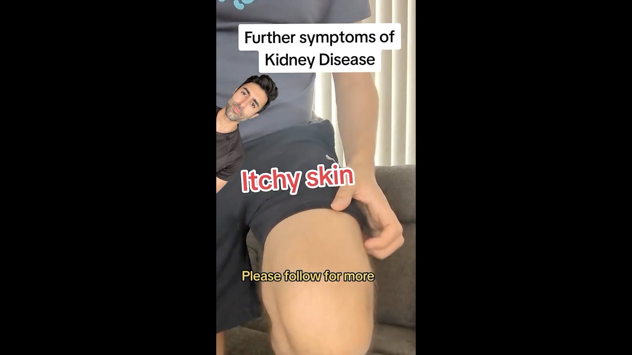 These Subtle Symptoms Could Mean Kidney Trouble